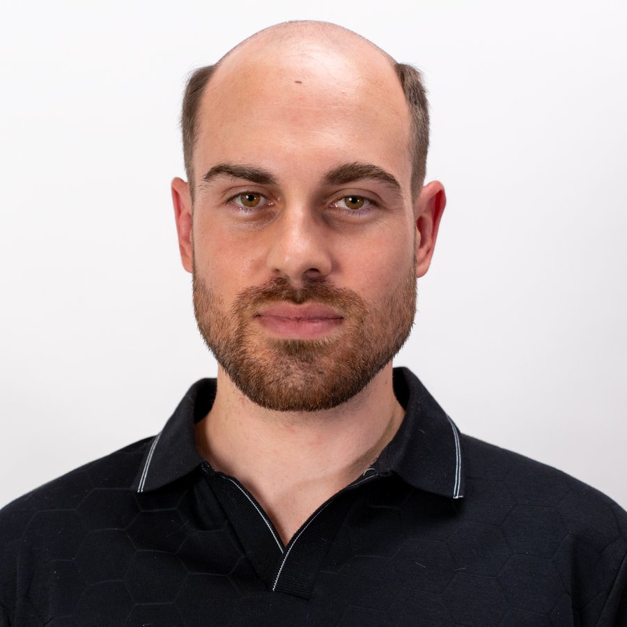 Real Gen'C client before — hair loss